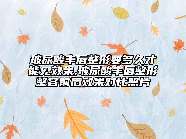 玻尿酸豐唇整形要多久才能見(jiàn)效果,玻尿酸豐唇整形整容前后效果對(duì)比照片