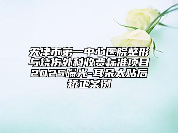 天津市第一中心醫(yī)院整形與燒傷外科收費(fèi)標(biāo)準(zhǔn)項(xiàng)目2025曝光-耳朵太貼后矯正案例