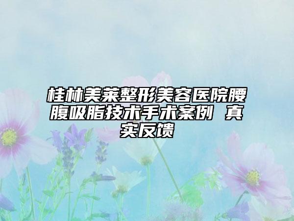 桂林美萊整形美容醫(yī)院腰腹吸脂技術手術案例 真實反饋