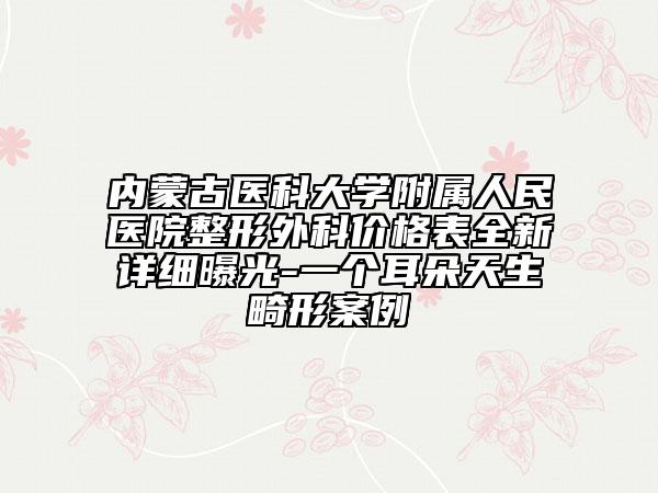 內(nèi)蒙古醫(yī)科大學(xué)附屬人民醫(yī)院整形外科價格表全新詳細(xì)曝光-一個耳朵天生畸形案例