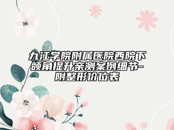 九江學(xué)院附屬醫(yī)院西院下頜角提升親測案例細(xì)節(jié)-附整形價(jià)位表