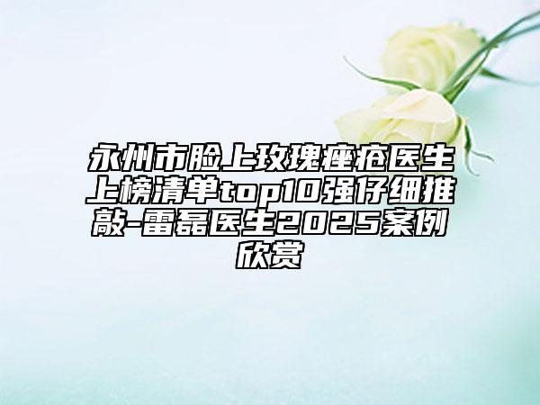 永州市臉上玫瑰痤瘡醫(yī)生上榜清單top10強仔細推敲-雷磊醫(yī)生2025案例欣賞
